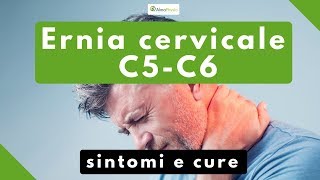 ernia cervicale C5 C6 sintomi e cure [upl. by Dodi]