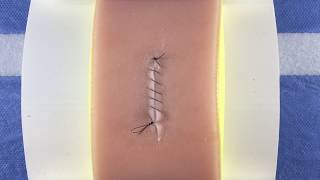 Simple Continuous Running Baseball Suture [upl. by Calia]