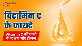 ✅Vitamin C क्यों जरुरी है Vitamin C की कमी के लक्षण और ईलाज ✅ Vitamin C Benefits for Skin [upl. by Hardigg884]