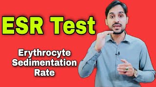 ESR Test  Erythrocyte Sedimentation Rate  High ESR Causes [upl. by Tdnaltroc]