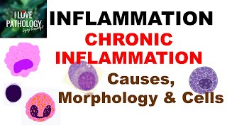 INFLAMMATION 8 CHRONIC INFLAMMATION Causes Morphology amp Cells [upl. by Elayor914]