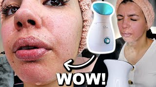 I Tested The Best FACIAL STEAMER On Amazon [upl. by Muir]