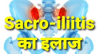 Root Canal Treatment  Hindi [upl. by Atinod]