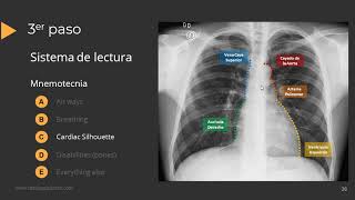 Tutorial Radiografía de Torax [upl. by Cinom]