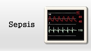 Sepsis 101 Diagnosis and Treatment [upl. by Rudie520]