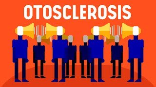 What is Otosclerosis [upl. by Annuhsal83]