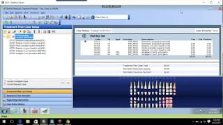 Dentrix Treatment Planner Module [upl. by Lednahs]