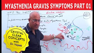 Myasthenia Gravis  Symptoms and Treatment  Part 2🩺 [upl. by Roland]