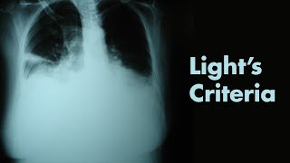 Lights Criteria amp Pleural Effusions  MEDZCOOL [upl. by Hayidan263]