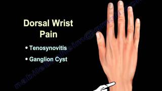 Top 5 Mistakes to AVOID after a Wrist Fracture or Injury [upl. by Ettenotna]