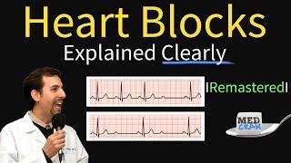 Heart Blocks Explained  First Second Third Degree and Bundle Branch on ECG [upl. by Elon]