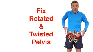 Best Rotated Pelvis Correction Exercises [upl. by Sandie]