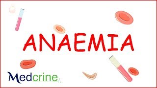 Anemia  causes classification clinical features treatment [upl. by Lemuelah]