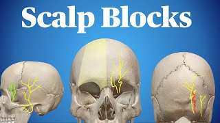 Scalp Blocks [upl. by Epps]