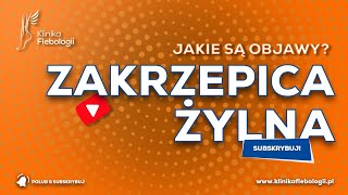 ZAKRZEPICA ŻYLNA  jakie są jej objawy [upl. by Adlar227]