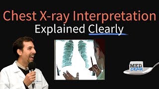 Chest XRay Interpretation Explained Clearly  How to read a CXR [upl. by Etneciv]