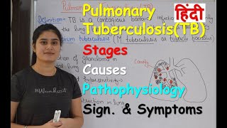 Tuberculosis TB के कारण लक्षण और उपचार – Tuberculosis Causes Symptoms amp Treatment in Hindi [upl. by Kcuhc103]