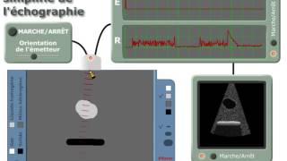 Radio du thorax  ABCDEFGHI  Partie 2  Docteur Synapse [upl. by Llertrac]