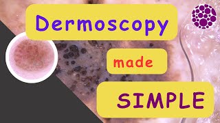 Dermoscopy made simple [upl. by Hassin]