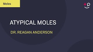 Atypical Moles What Are They Dermatology 2019 [upl. by Nakhsa]