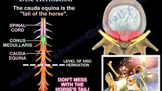 BEST Exercise for a Lower Lumbar Herniated Disc L4 L5 S1 [upl. by Knowle517]