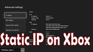 How to Setup Static IP on Xbox One [upl. by Sesom]