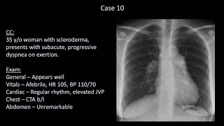 How to Interpret a Chest XRay Lesson 10  Self Assessment Part 2 [upl. by Erreit865]