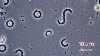 Spirilla bacteria seen through a compound microscope [upl. by Asillam]