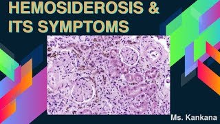 What are Hemosiderosis and its symptoms Biotechnology  General Medicine [upl. by Dobson]