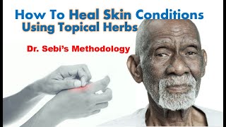 Topical Herbal Skin Treatments  Dr Sebi Methodology [upl. by Fronia199]