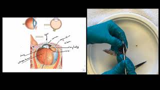 Eye Dissection Instructions [upl. by Vito]