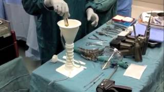 TKA Bone Cement Technique [upl. by Nefets]