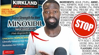 Why I STOPPED USING Minoxidil to Improve my Beard Growth  Dont use Minoxidil Before Watching This [upl. by Adelaide]