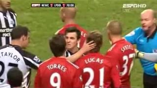 Joey Barton Fight Fernando Torres [upl. by Westhead482]