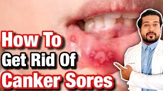 Reasons for getting sore tongue and how to treat them [upl. by Steffin452]