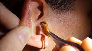 Technique japonaise pour déboucher les oreilles 3 ASMR [upl. by Amuwkuhc808]