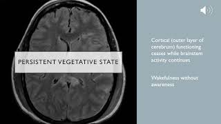 Clinical Death Whole Brain Death and Persistent Vegetative State [upl. by Furlani883]