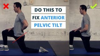 6 Minute Routine to Correct ANTERIOR Pelvic Tilt [upl. by Tressa439]