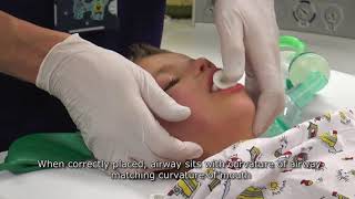 Paediatric Anaesthetics Chapter 1  Mask anaesthesia after iv induction [upl. by Acissehc]