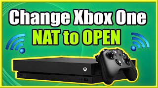 How to Change Xbox One NAT to OPEN and FIX Strict Connection Issues Easy Method [upl. by Swisher444]