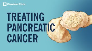 Treating Pancreatic Cancer [upl. by Jehial]