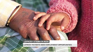 Types of Leprosy Lepromatous and Tuberculoid [upl. by Bonn342]