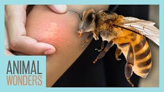 What You Need To Know About Bee Stings [upl. by Shannah975]