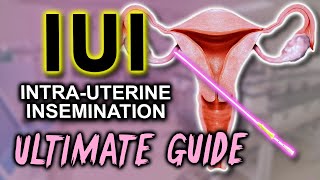 IUI  Fertility expert secrets for maximum pregnancy rates [upl. by Analahs]