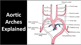 Patent Ductus Arteriosus slow [upl. by Darken211]