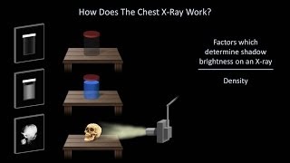 How to Interpret a Chest XRay Lesson 1  An Introduction [upl. by Keg]