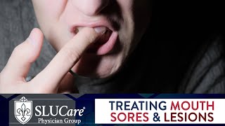 Mouth Sores amp Lesions Diagnosing and Treatment  SLUCare Otolaryngology [upl. by Sitoiyanap949]