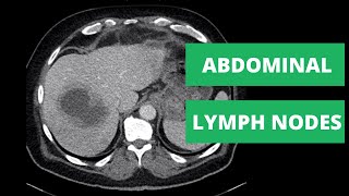 Abdominal CT Lymph Node Stations  How to read a CT [upl. by Juakn]