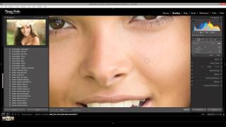 How to Quickly Clean Up Blemishes in Lightroom [upl. by Maxey450]