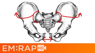 Bad Pelvic Fractures [upl. by Feld]